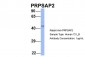 PRPSAP2 Antibody - N-terminal region